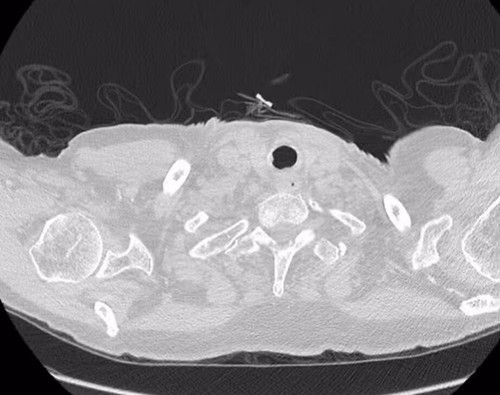 H fSEEipXWnb9GQQ.jpg