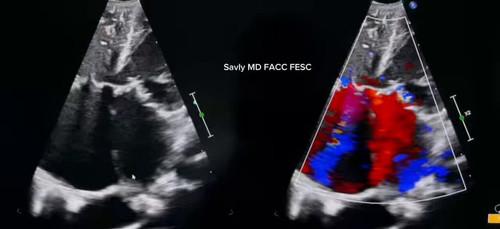 aabTaBxMyD 8vAn5.jpg