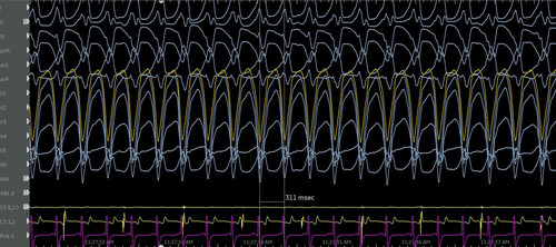 G alYw4WYAAgxzW?format=jpg.jpg