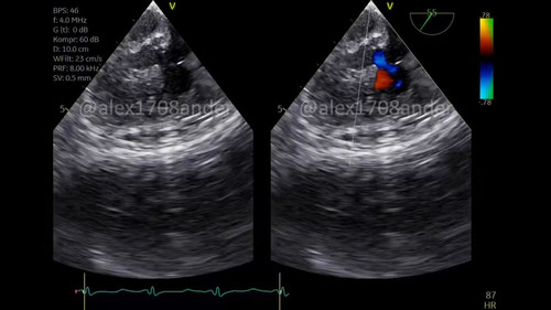 3y8nYFH4E9 jn83h.jpg