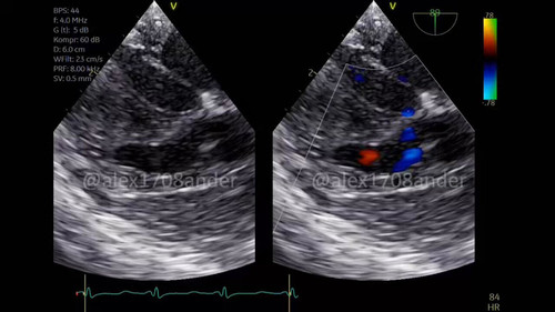 P8C4sl LxZTKMUt5.jpg