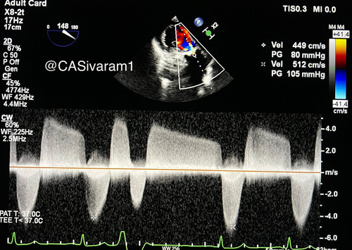 G dcjZ7WoAA6PMV?format=jpg.jpg