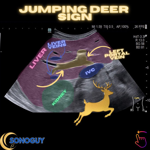 G eNuk2XUAAzMNF?format=jpg.jpg