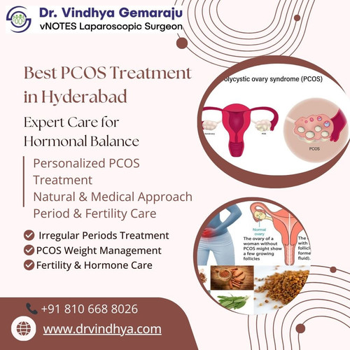 Best PCOS Treatment in Hyderabad image.jpg