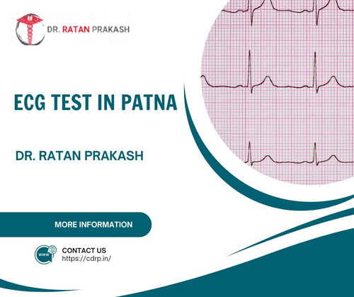 ECG Test in Patna: Dr. Ratan Prakash.jpg