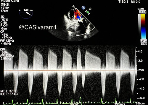 G dcjZ7WkAAKcFq?format=jpg.jpg