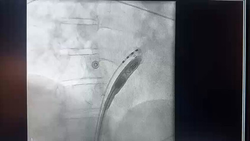 r2STNAw xNrOgS M.jpg