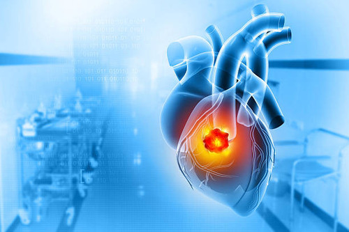 Prevent Autism - Resplice Institute.jpg