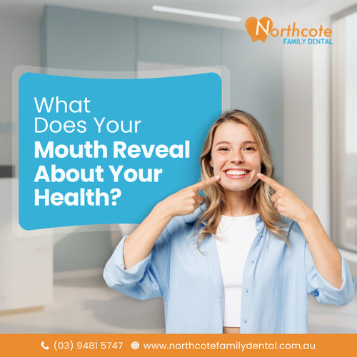 What Does Your Mouth Reveal About Your Health.jpg