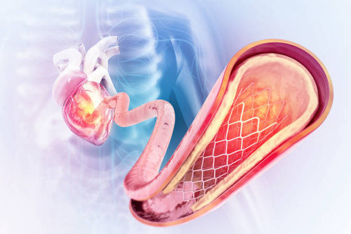 Cardiologist Fremont Ca - Rajesh Sam Suri.jpg