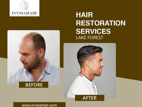 Hair Restoration Services Lake Forest.jpg