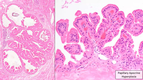 G7FV8ZLXAAATf k.jpg