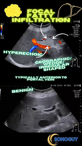 po 3CYcXhfyVl2HB.jpg