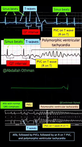 Lqi04ZVx5uq6k H9.jpg