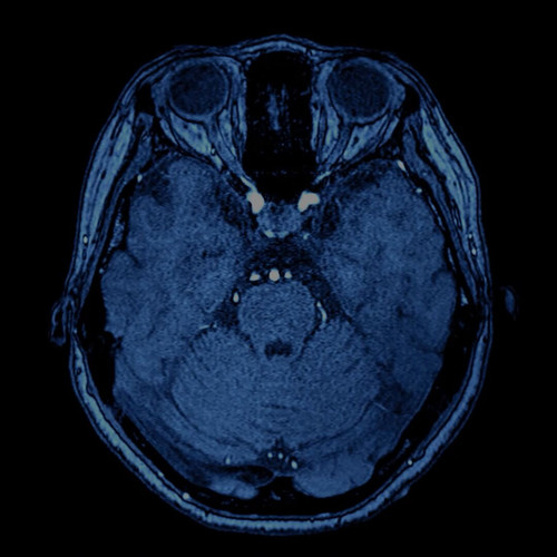 muhTrxeGCSWx8V 0.jpg