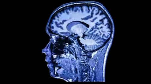 PupU CBqrQsvxd4v.jpg