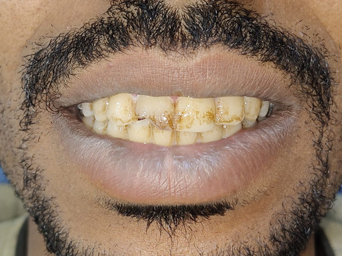 291ec628 42cd 459f b403 e7e08d945c30.jpg