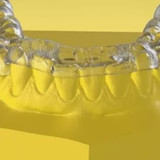 Сплинт терапия