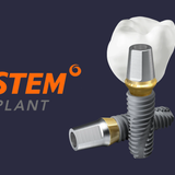 Установка импланта Osstem в Москве