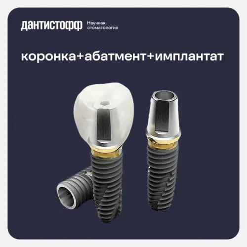 Имплантация Osstem с циркониевой коронкой в Москве.webp