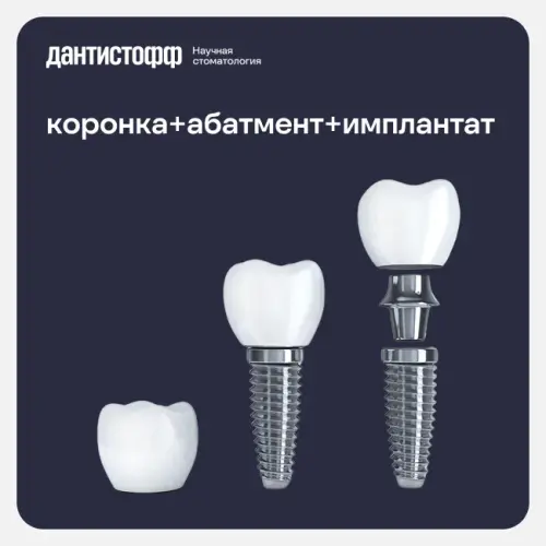 Имплантация Straumann с циркониевой коронкой в Москве.webp