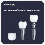 Имплантация Straumann с циркониевой коронкой в Москве