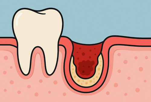 Лечение альвеолита.jpg