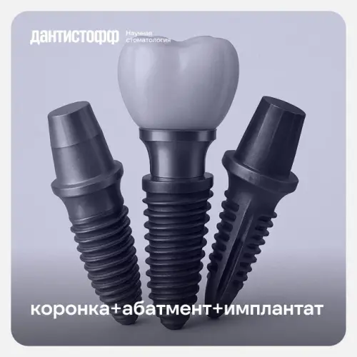 Имплантация Neodent с циркониевой коронкой в Москве.webp