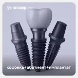 Имплантация Neodent с циркониевой коронкой в Москве