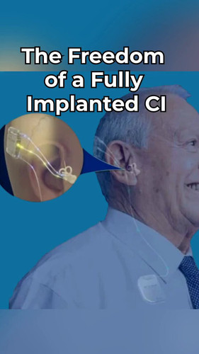 CGH SxZbQUa hXSe.jpg