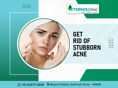 Skin specialist in kothrud.jpg