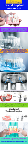 Dental Implant Assessment.png