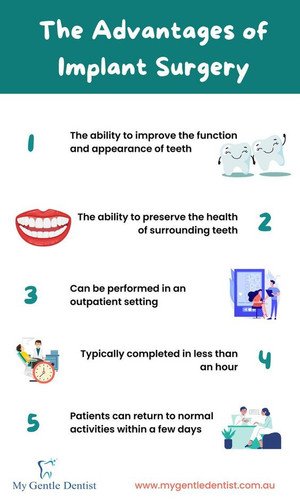 The Advantages of Implant Surgery.jpg