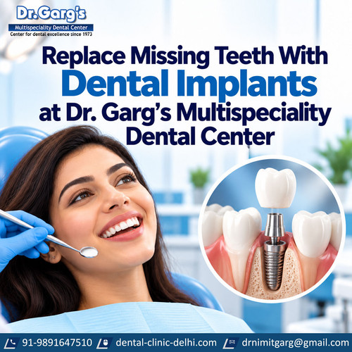 Replace Missing Teeth With Dental Implants at Dr. Garg’s Multispeciality Dental Center.jpg