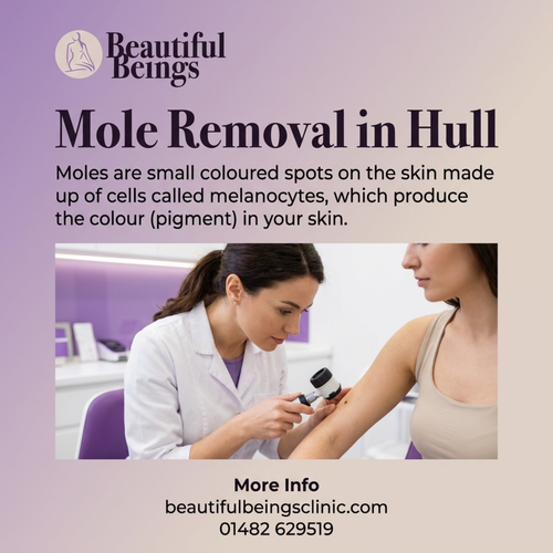 Mole Removal in Hull.png