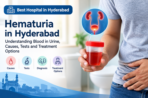 Best Hospital in Hyderabad.2