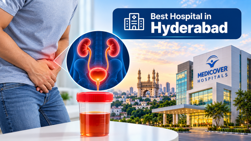 Best Hospital in Hyderabad.2