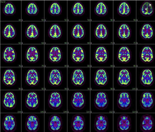 brains.jpg