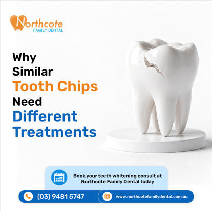 Why similar tooth chips need different treatments.png
