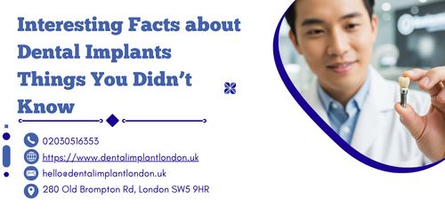Interesting Facts about Dental Implants Things You Didn’t Know.png