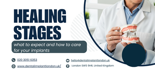 Healing stages what to expect and how to care for your implants.png