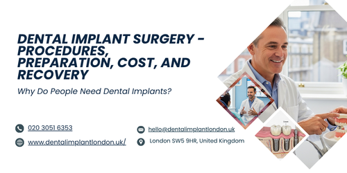 Dental Implant Surgery Procedures, Preparation, Cost, and Recovery.png