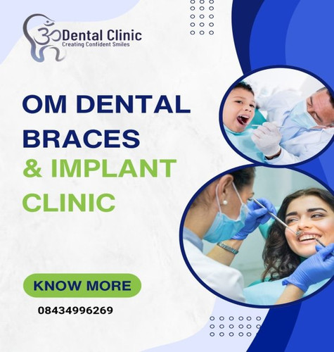 Best Dental Clinic in Patna: Om Dental Braces & Implant Clinic.jpg