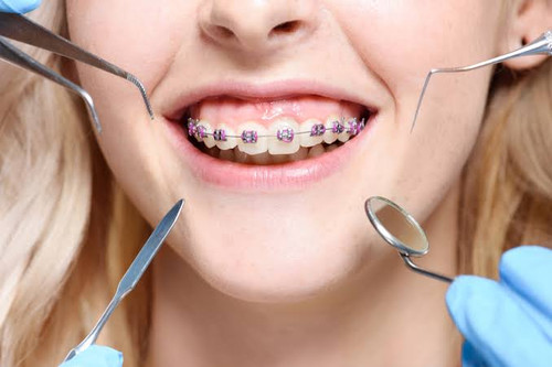 Natomas Braces.jpg