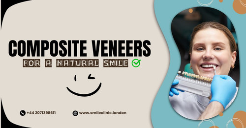 Composite Veneers for a Natural Smile.jpg