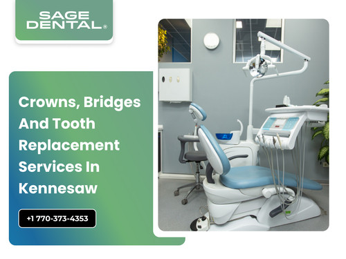 Crowns, Bridges and Tooth Replacement Services in Kennesaw.jpg