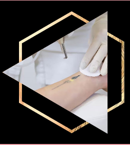 Scar Camouflage Permanent Makeup.png