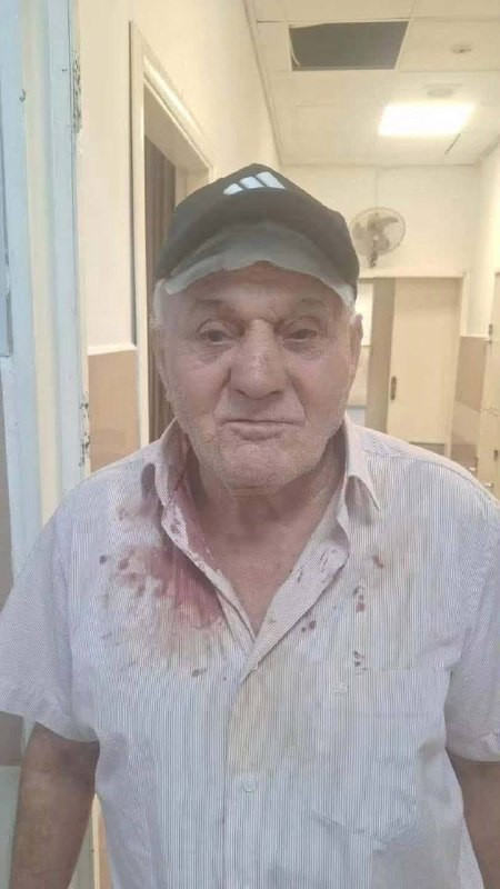 مستوطنون يعتدون بالضرب على المزارع "محمد الطويل" أثناء عمله داخل أرضه في قرية دير إبزيع، غرب رام الله....