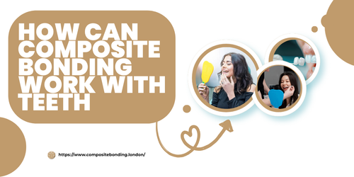 How Can Composite Bonding Work With Teeth Whitening.png