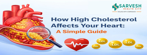 how high cholesterol affects your heart a simple guide.1